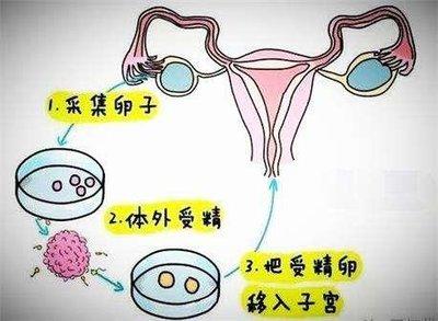 国内哪里可以借卵生子(国内哪里可以借卵生子？)