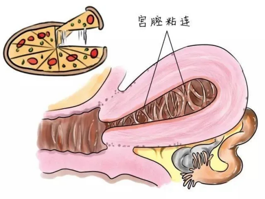 代怀小孩哪里好【代怀小孩哪里好?选择优质代怀机构需谨慎】